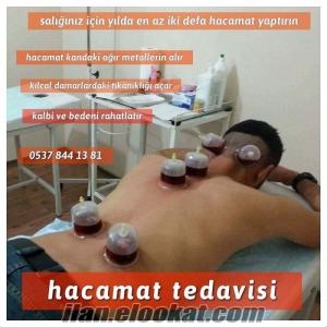 küçükçekmece hacamat